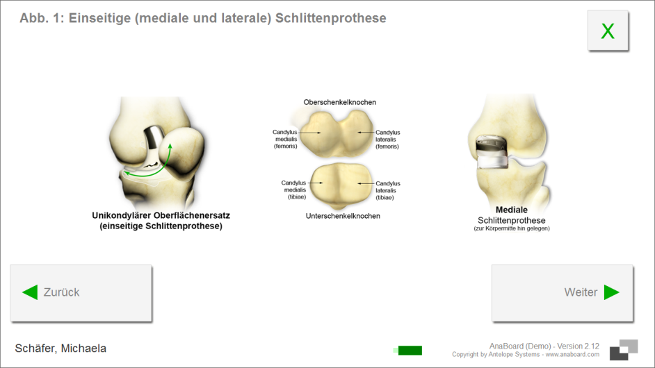 Digitale Formulare: Bildliche Darstellung Teilprothesen