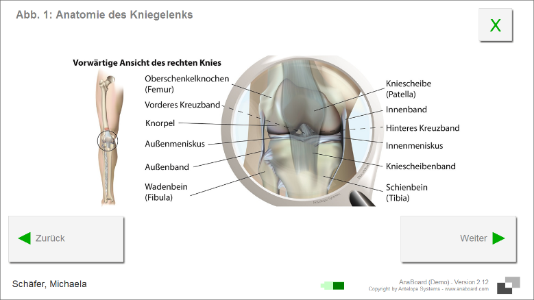 Digitale Formulare: Aufbau eines Kniegelenks